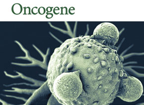 「輝駿客戶文章」Oncogene| 質譜技術篩查鼻咽癌中l(wèi)ncRNA的結合蛋白